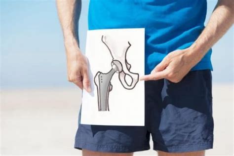 hip arthroplasty icd 10
